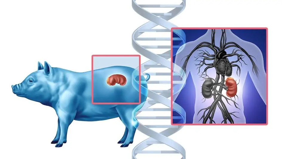 Chinese Surgeons Perform First Pig-To-Human Organ Transfer